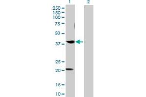 Western Blot analysis of CABLES1 expression in transfected 293T cell line by CABLES1 MaxPab polyclonal antibody. (CABLES1 anticorps  (AA 1-368))