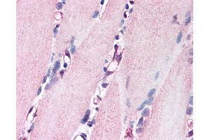 Anti-NRG1 antibody IHC of human skeletal muscle.