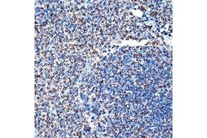 Immunohistochemistry of paraffin-embedded rat spleen using DCR2 Rabbit mAb (ABIN7271063) at dilution of 1:100 (40x lens).