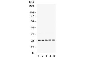 Western blot testing of 1) rat testis, 2) rat lung, 3) human 293, 4) human HeLa and 5) human HepG2 lysate with RAB18 antibody. (RAB18 anticorps)