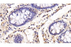 Detection of FAS in Porcine Colon Tissue using Polyclonal Antibody to Factor Related Apoptosis (FAS)