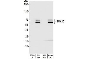 Western Blotting (WB) image for anti-SRY (Sex Determining Region Y)-Box 10 (SOX10) (AA 416-466) antibody (ABIN7454037)
