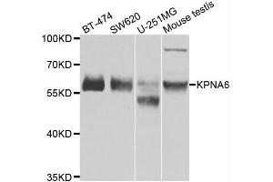 Western blot analysis of extracts of various cell lines, using KPNA6 antibody. (KPNA6 anticorps  (AA 277-536))