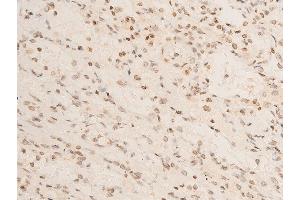 ABIN6267069 at 1/100 staining human TB tissue sections by IHC-P.