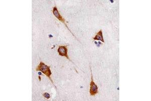 (ABIN6243853 and ABIN6577112) staining FA in human brain sections by Immunohistochemistry (IHC-P - paraformaldehyde-fixed, paraffin-embedded sections). (FAM120A anticorps)