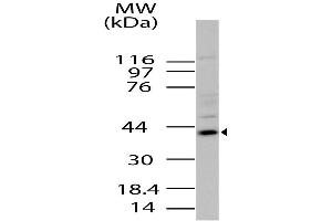 Image no. 1 for anti-Radical S-Adenosyl Methionine Domain Containing 2 (RSAD2) (AA 100-330) antibody (ABIN5027637) (RSAD2 anticorps  (AA 100-330))
