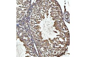 IHC analysis of USP26 using anti-USP26 antibody (ABIN7599543). (USP26 anticorps  (AA 1-762))