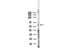 Western blot analysis of lysates from F10-LUC cells(heat-shock,45 min treatment), using CDK8 Antibody at 1/1000 dilution.