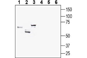 Solute Carrier Family 2 (Facilitated Glucose Transporter) Member 8 (SLC2A8) peptide