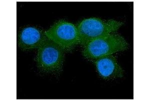 IF analysis of RAB27A using anti-RAB27A antibody (ABIN7602714). (RAB27A anticorps  (AA 98-216))
