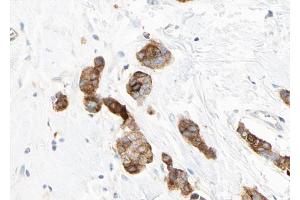 ABIN6268773 at 1/100 staining human breast tissue sections by IHC-P.