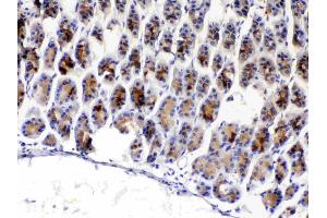 IHC analysis of TFF3 using anti-TFF3 antibody .