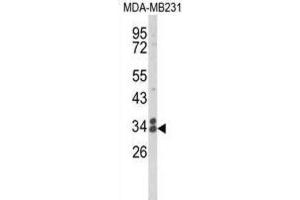 Western Blotting (WB) image for anti-Clathrin, Light Chain A (CLTA) antibody (ABIN3004002) (CLTA anticorps)