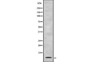 Western blot analysis of Defensin alpha4 using HuvEc whole cell lysates (DEFA4 anticorps)