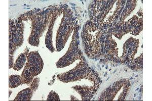 Image no. 5 for anti-Prefoldin Subunit 3 (PFDN3) antibody (ABIN1501704)