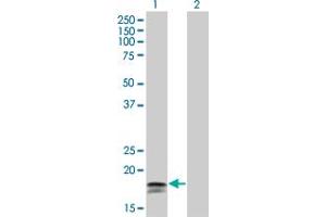 Western Blot analysis of IFNA2 expression in transfected 293T cell line by IFNA2 monoclonal antibody (M33), clone 4H3. (IFNA2 anticorps  (AA 24-188))