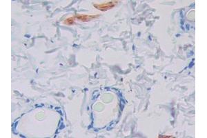 Used in DAB staining on fromalin fixed paraffin- embedded stomach tissue (PIP anticorps  (AA 41-139))