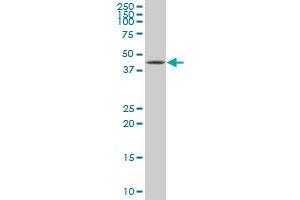 XBP1 monoclonal antibody (M01), clone 3F5. (XBP1 anticorps  (AA 123-225))
