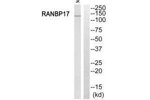 Western blot analysis of extracts from Jurkat cells, using RANBP17 antibody. (RANBP17 anticorps  (N-Term))
