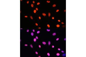 Immunofluorescence analysis of NIH-3T3 cells using MonoMethyl-Histone H2B-K5 antibody (ABIN7267735) at dilution of 1:100.