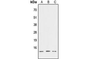 Western blot analysis of ATP6V1G3 expression in HEK293T (A), NIH3T3 (B), PC12 (C) whole cell lysates. (ATP6V1G3i anticorps  (Center))
