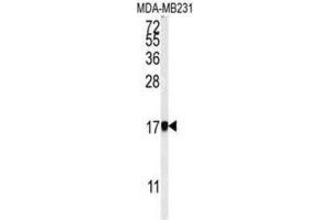 Western Blotting (WB) image for anti-Adaptor Related Protein Complex 1 sigma 1 (AP1S1) antibody (ABIN3002203) (AP1S1 anticorps)