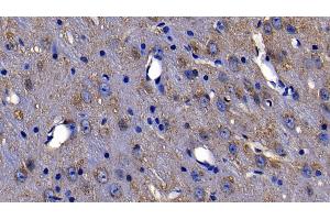 Detection of LY96 in Mouse Cerebrum Tissue using Polyclonal Antibody to Lymphocyte Antigen 96 (LY96) (LY96 anticorps  (AA 19-130))