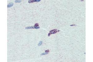 PRDM9 antibody was used for immunohistochemistry at a concentration of 4-8 ug/ml. (PRDM9 anticorps  (Middle Region))