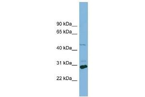 SLC16A1 antibody used at 1 ug/ml to detect target protein.