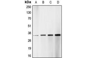 Western blot analysis of CDK1/2/3 (pT14) expression in HT29 hydroxyurea-treated (A), HeLa (B), NIH3T3 (C), A431 (D) whole cell lysates. (CDK1/2/3 (N-Term), (pSer14) anticorps)