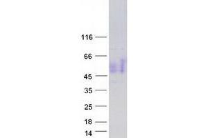 Validation with Western Blot