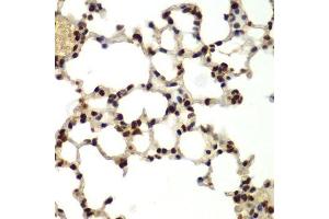 Immunohistochemistry of paraffin-embedded mouse lung using DDX5 antibody.