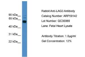 WB Suggested Anti-LAG3  Antibody Titration: 0. (LAG3 anticorps  (C-Term))
