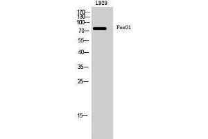 Western Blotting (WB) image for anti-Forkhead Box O1 (FOXO1) (Ser380) antibody (ABIN3175131) (FOXO1 anticorps  (Ser380))