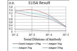 Black line: Control Antigen (100 ng), Purple line: Antigen(10 ng), Blue line: Antigen (50 ng), Red line: Antigen (100 ng), (DARPP32 anticorps  (AA 95-204))