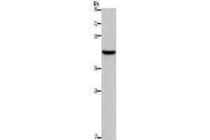 Western Blotting (WB) image for anti-Transcription Factor Dp-1 (TFDP1) antibody (ABIN5544342) (DP1 anticorps)