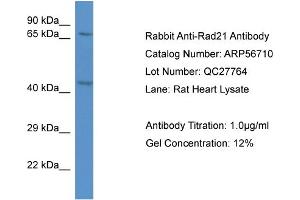Western Blotting (WB) image for anti-RAD21 Homolog (RAD21) (C-Term) antibody (ABIN2786858) (RAD21 anticorps  (C-Term))