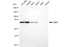 Western blotting analysis using GBE1 antibody (ABIN7798727).