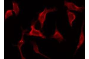 ABIN6275772 staining HeLa by IF/ICC. (IL17RC anticorps  (C-Term))