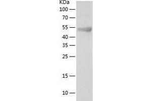 TOR1AIP2 Protein (AA 2-214) (His tag)