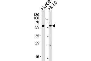 Western Blotting (WB) image for anti-Fanconi Anemia, Complementation Group C (FANCC) antibody (ABIN3004210) (FANCC anticorps)