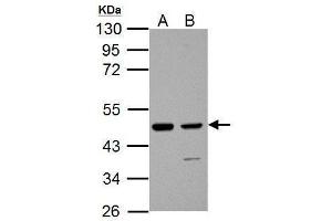 WB Image Sample (30 ug of whole cell lysate) A: JC B: C2C12 10% SDS PAGE antibody diluted at 1:1000 (IDH1 anticorps  (Center))