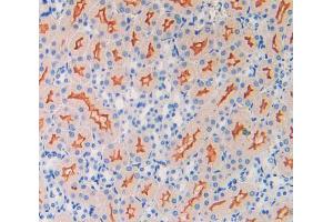 Used in DAB staining on fromalin fixed paraffin- embedded kidney tissue (Oxytocin Receptor anticorps  (AA 6-75))