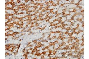 Immunoperoxidase of monoclonal antibody to TIMM8A on formalin-fixed paraffin-embedded human liver.