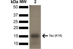 SDS-PAGE of ~16 kDa Human Tau Protein K18 P301L Monomer (ABIN6929394, ABIN6929395 and ABIN6929396). (tau Protein (partial, Pro301Leu-Mutant))
