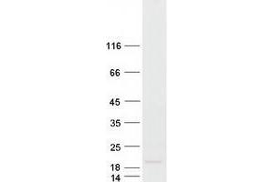 KiSS-1 Metastasis-Suppressor (KISS1) protein (Myc-DYKDDDDK Tag)