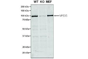 Western Blot analysis of Human, Mouse A549, MEF showing detection of VPS35 protein using Mouse Anti-VPS35 Monoclonal Antibody, Clone 7E4 (ABIN6932910). (VPS35 anticorps  (Atto 488))