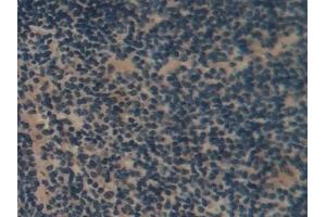 Detection of RAGE in Rat Spleen Tissue using Polyclonal Antibody to Renal Tumor Antigen (RAGE)