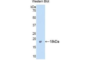 Detection of Recombinant ITIH4, Human using Polyclonal Antibody to Inter Alpha-Globulin Inhibitor H4 (ITIH4)