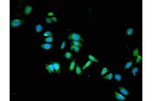Immunofluorescent analysis of HepG2 cells using ABIN7149930 at dilution of 1:100 and Alexa Fluor 488-congugated AffiniPure Goat Anti-Rabbit IgG(H+L)